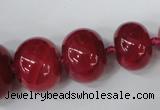 CAG5423 8*12mm – 20*30mm rondelle dragon veins agate beads