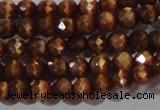 CCT319 15 inches 4mm faceted round cats eye beads wholesale